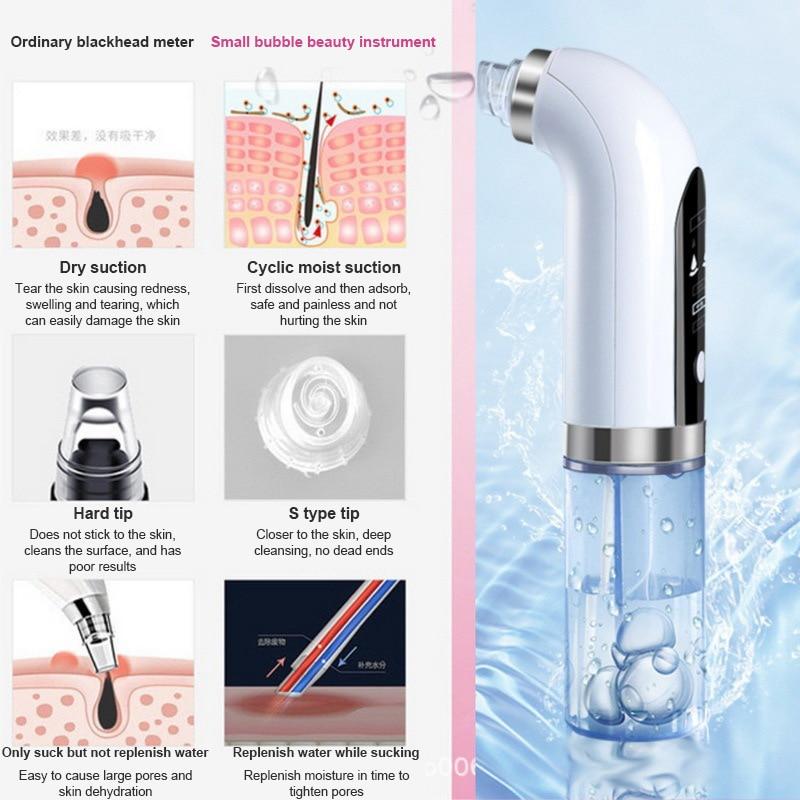 Electric Bubble Vacuum Blackhead Remover - Uniq Niche